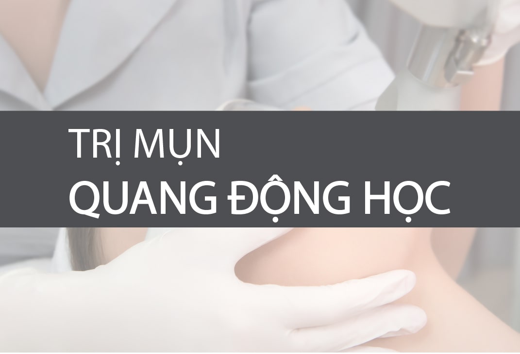 trị mụn quang động học