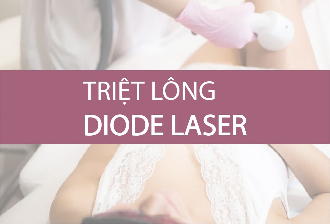 triệt lông diode laser