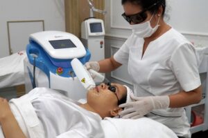 Trị mụn bằng phương pháp IPL có hiệu quả?